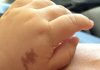 Engineer, 37, has grand plans for son born with square root birthmark